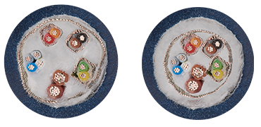 CF torsional movement